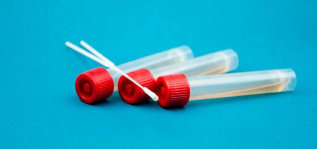 CORONAVIRUS, PRATICO’ (CATANZARO DA VIVERE): “CHIEDO ALL’ASP DI EFFETTUARE TAMPONI A TUTTI I FARMACISTI”